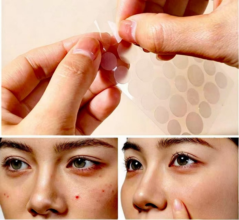 Quomodo utendum CmallBio Pimple Patches pernoctare ad maximum Results