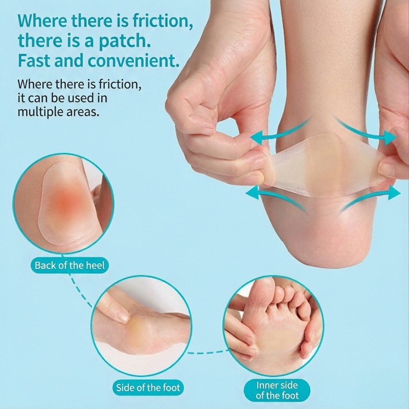 Calcaneum Calluses et Cornus: Potestne Hydrocolloid mollire et sublevare?