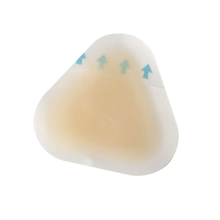 Sterilis pustula praeventionis ad calcem